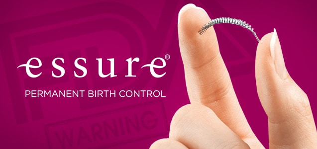 essure-birth-control